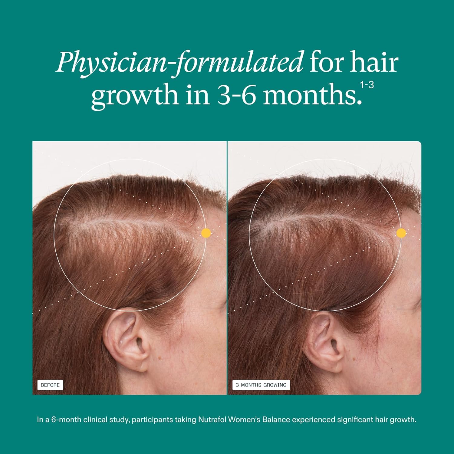 Thicker Hair Growth Vitamins