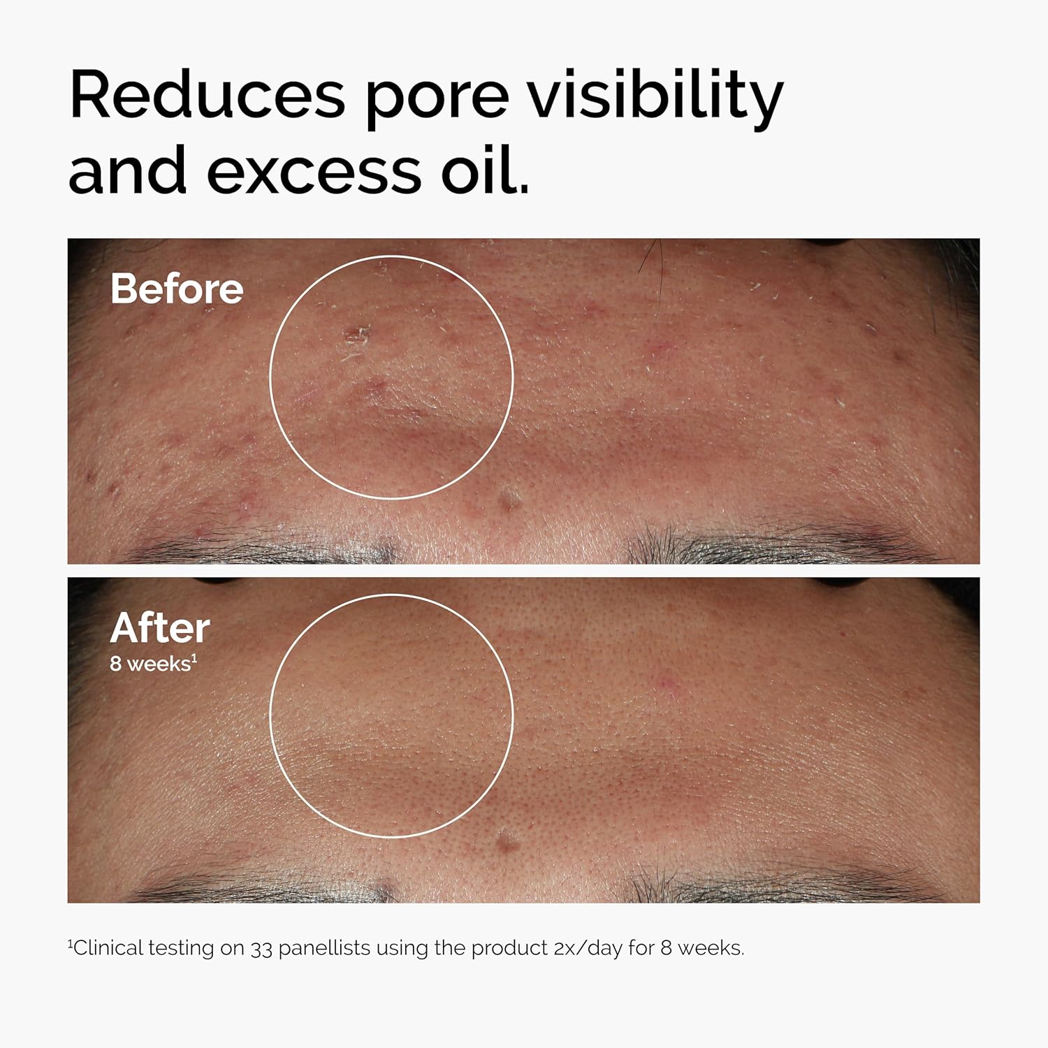 Blemish-Free Glow Serum