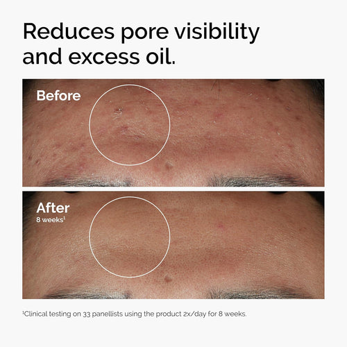 Blemish-Free Glow Serum